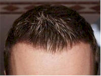 before-after-photos3