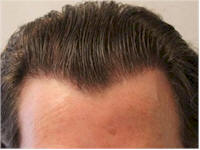 dr mwamba hairline gallery