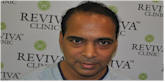 KSHITIZ CHAUDHARY at Dr. Sohi clinic