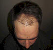 dr bhatti uk patient
