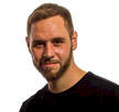 dr bhatti hair transplant patient uk