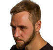 hair surgery in chandigarh india