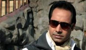 binnu dhillon fue hair transplant india