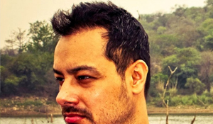 bobby sandhu hair replacement india