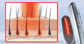 hairmax lasercomb