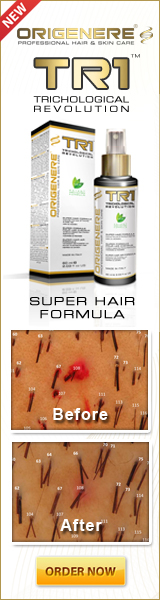 origenere hair regrowth treatment